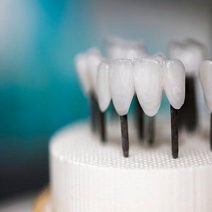Dental Implant — Dental Restoration in Bonita Springs, FL
