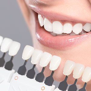 Dental Crowns — Tooth Appearance in Bonita Springs, FL
