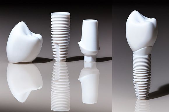 Keramik-Implantate aus Zirkondioxidkeramik: Gut körperverträglich