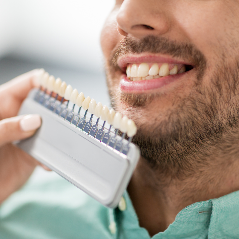 A man is holding a tooth color chart in front of his mouth.