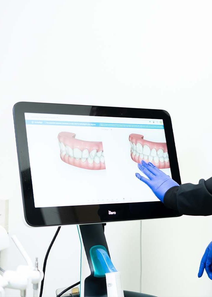 A person is pointing at an x-ray of a person 's teeth