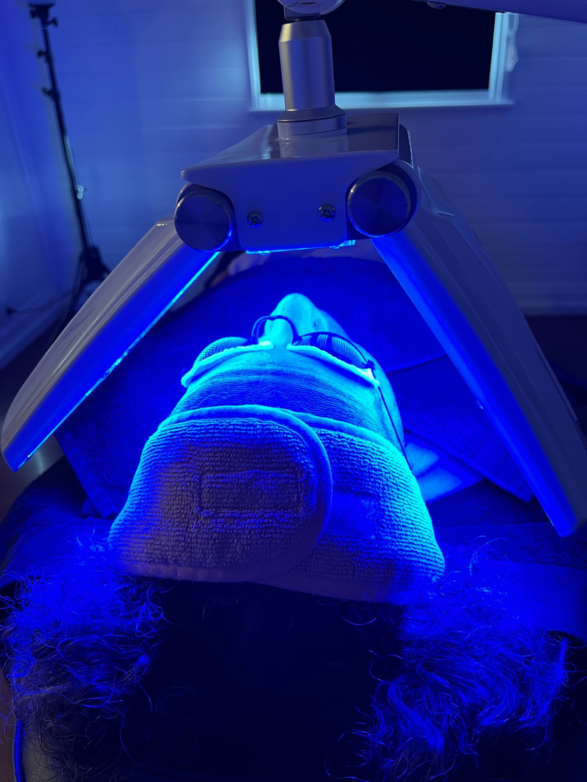 Lady Receiving Blue LED Therapy — Skin Clinic In Kiama, NSW