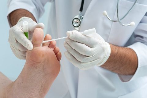 Athlete's foot care