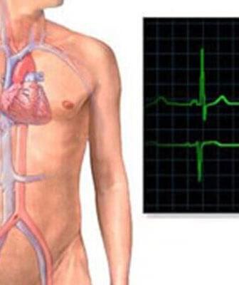 cardiólogo - DR. NELSON ELOY OCHOA BECERRA