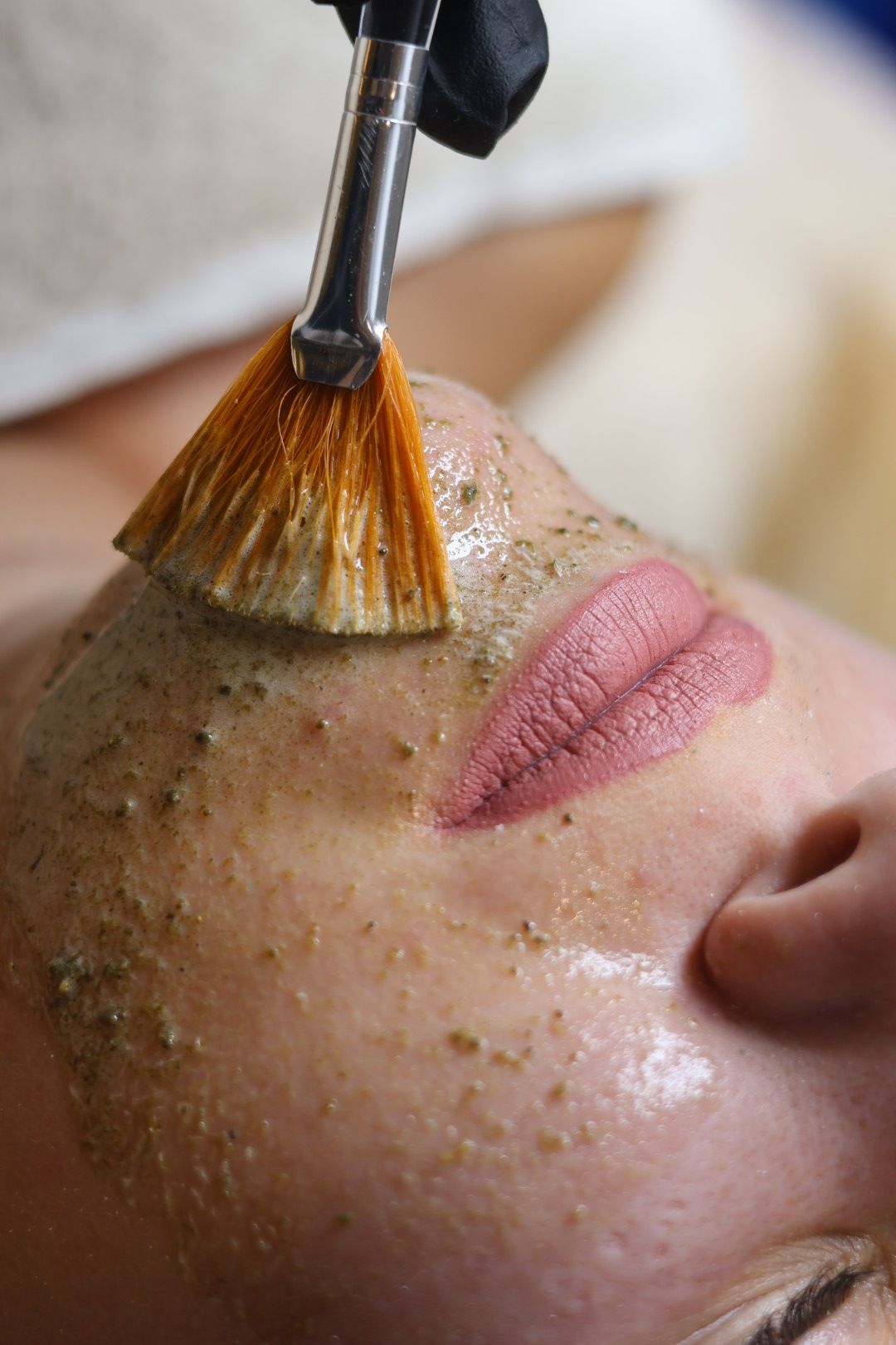 Facial peel treatment in progress; brush applies solution to face.