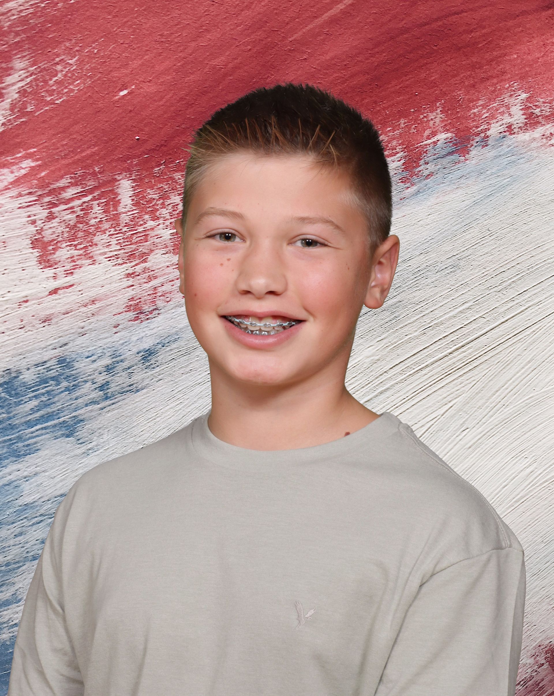A young boy with braces on his teeth poses for a picture