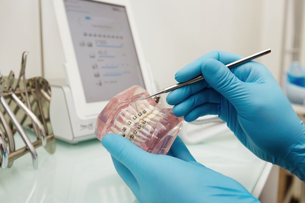 A Dentist is Examining a Model of Teeth With Braces — Ballina Denture Clinic Michael J Parker in Ballina, NSW