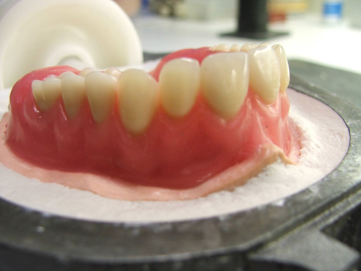A Close Up of a Denture on a Table — Ballina Denture Clinic Michael J Parker in Ballina, NSW