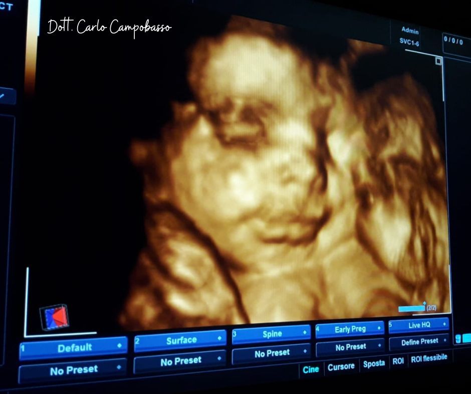 ecografia morfologica