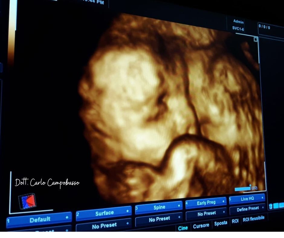ecografia morfologica 3D