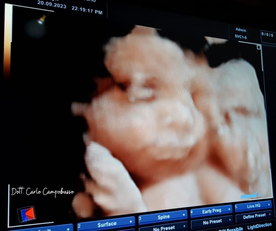 ecografia morfologica neonato