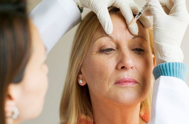 Filler in Boca Raton FL