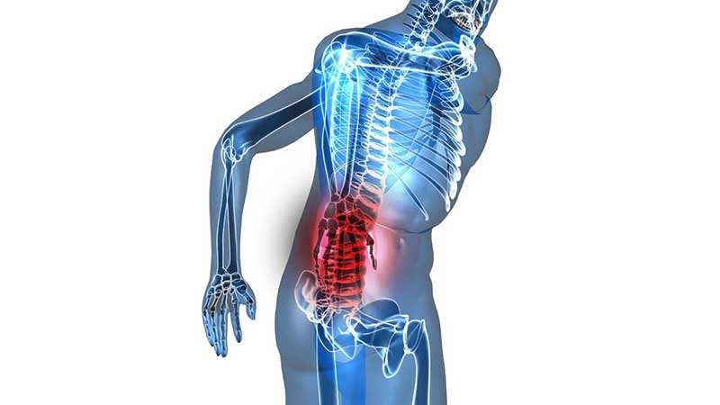 Should I Go to a Chiropractor After a Car Accident in St. Pete, FL