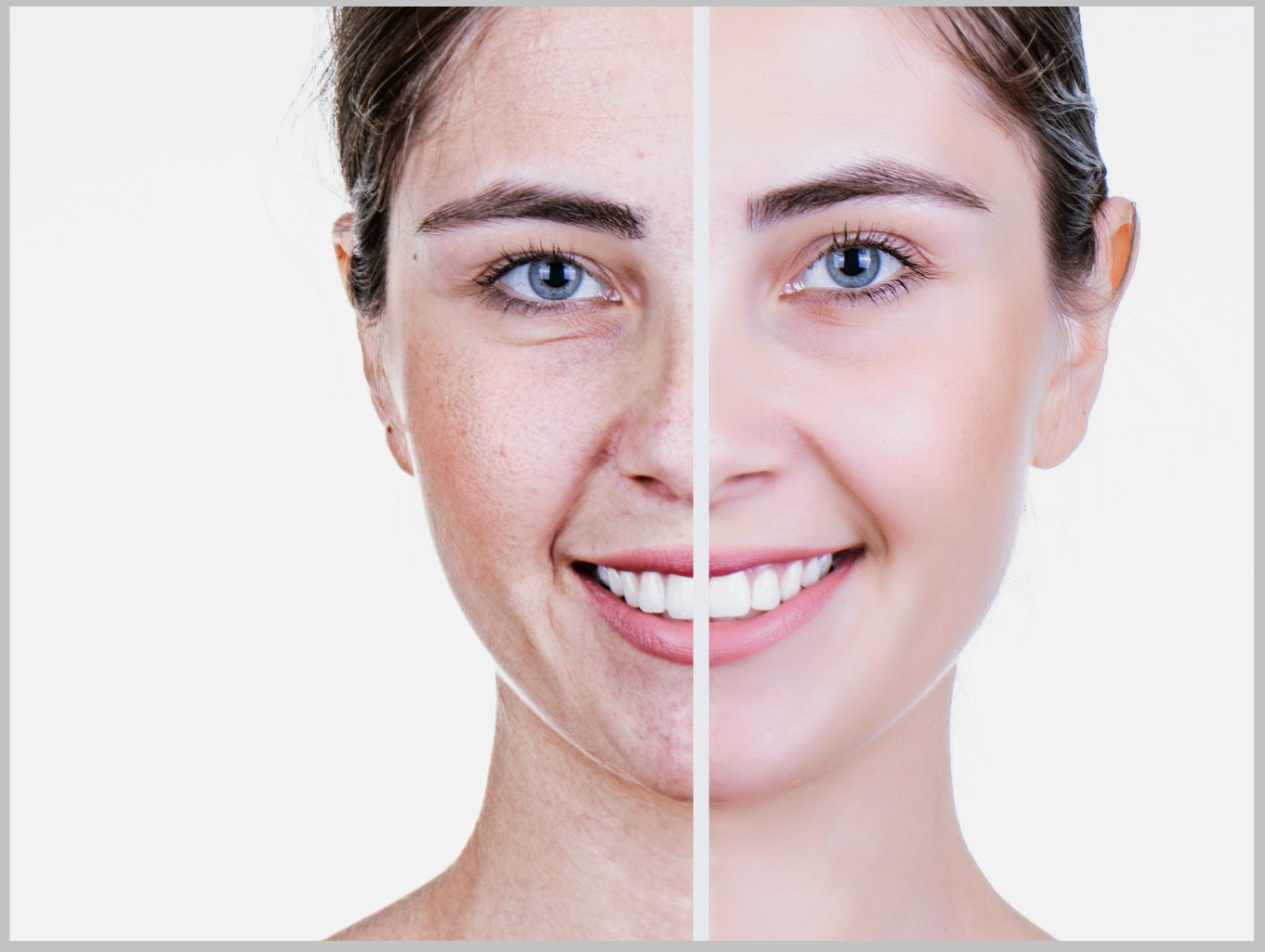 Anti-Aging Glycation Age Testing in St. Petersburg Florida. Call today to book an appointment!