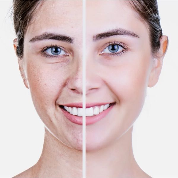 Anti-Aging Therapies in St. Petersburg Florida