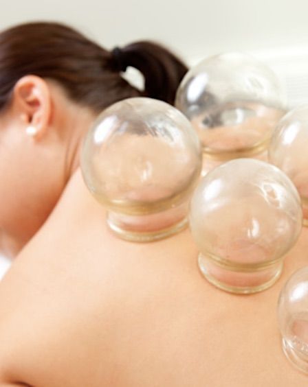 Fire Cupping Services in St. Petersburg Florida