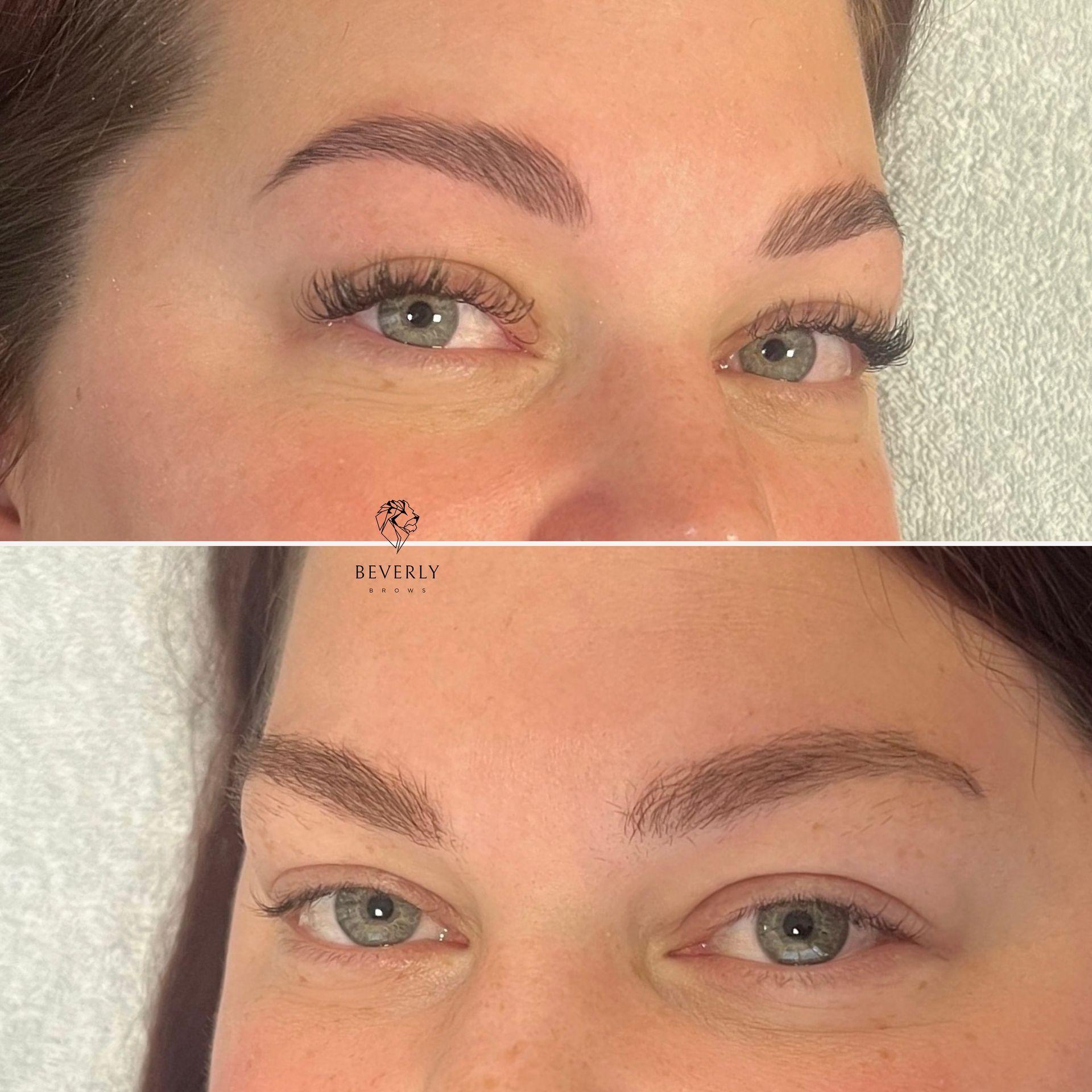 browlift Viernheim