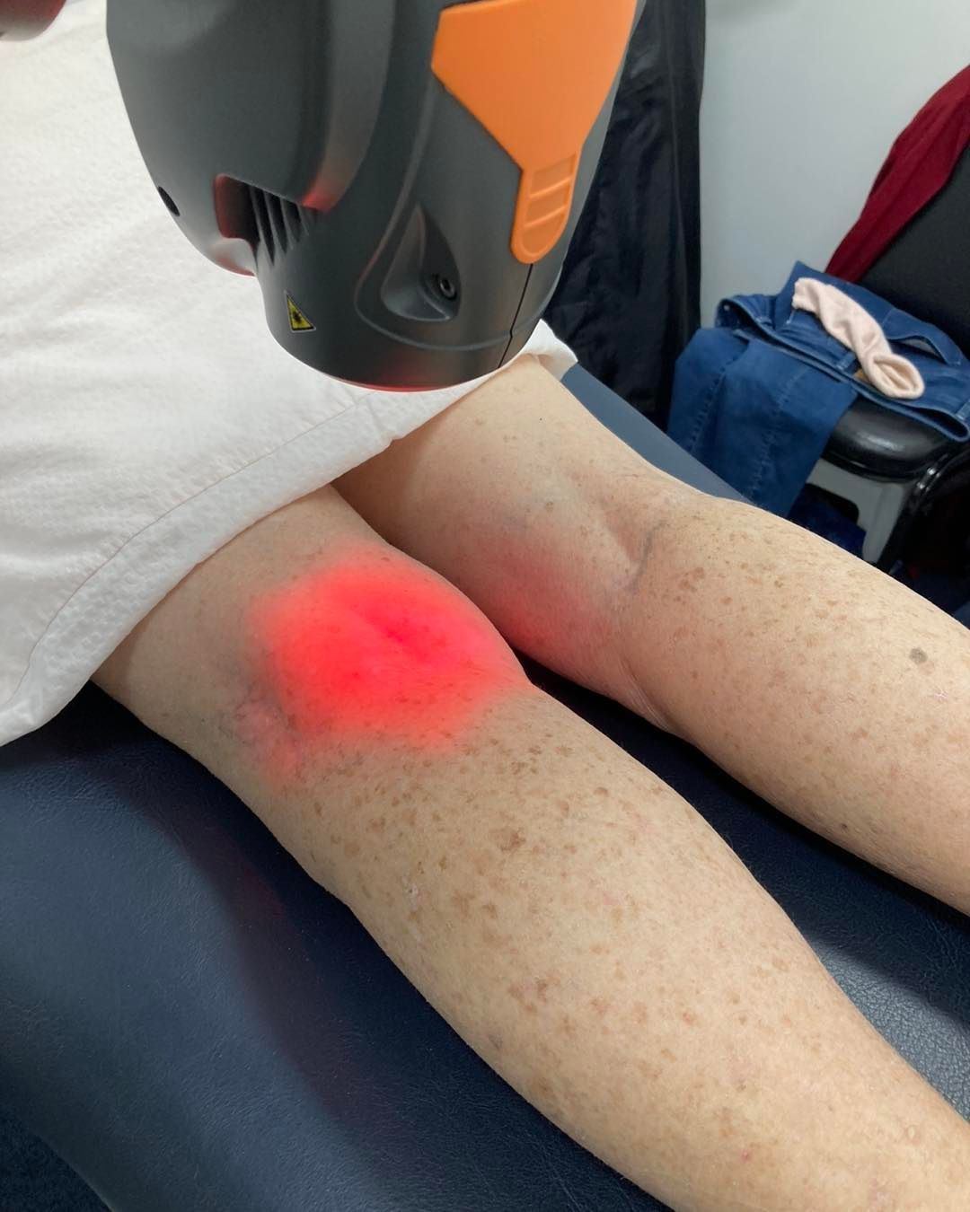 Laser Therapy Device Targeting a Patient's Knee — Sugarland Chiropractic Centre in Avoca, QLD