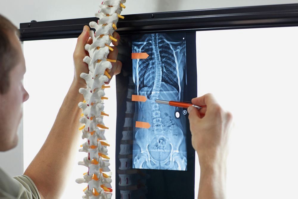 A Man is Looking at an X-ray of a Person 's Spine — Sugarland Chiropractic Centre in Avoca, QLD