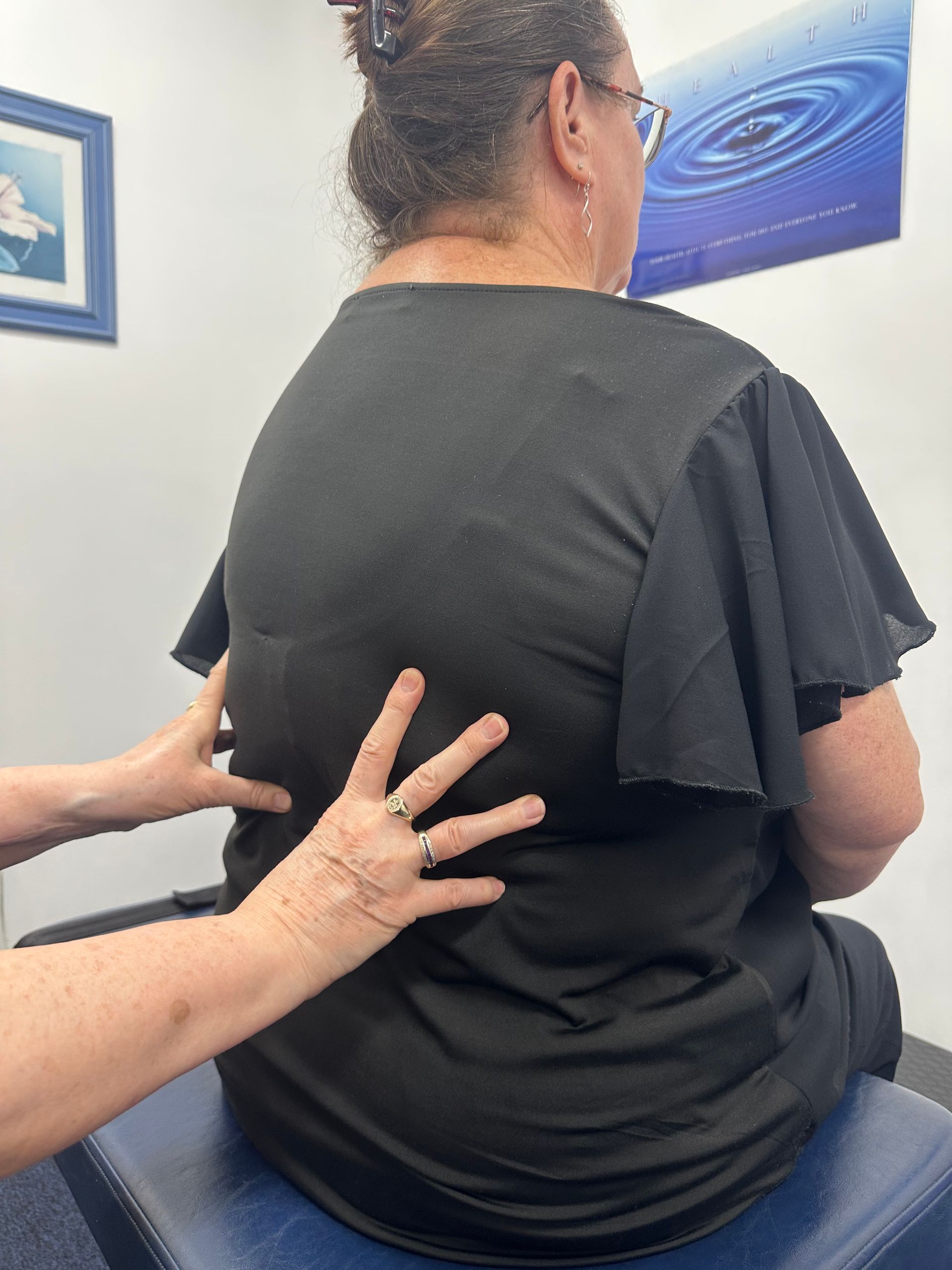 A Man is Sitting on a Table Getting a Massage From a Nurse — Sugarland Chiropractic Centre in Avoca, QLD