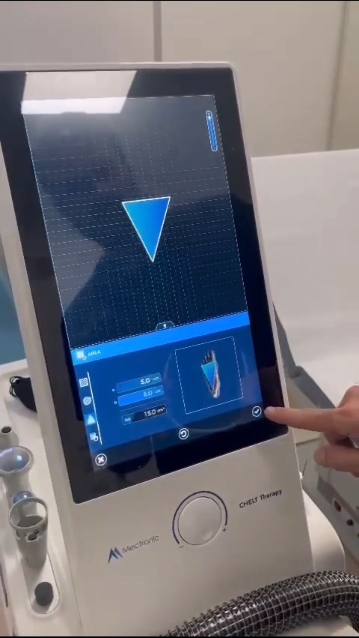 Ricostruzione del capello