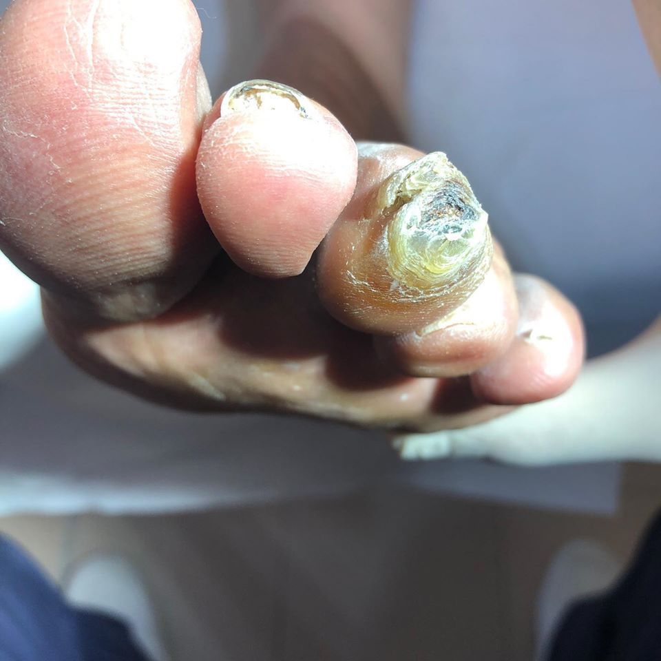 cura dei piedi podologo a Verona