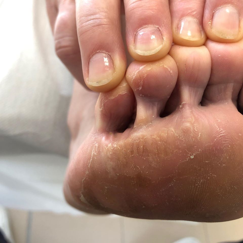 podologo a Verona per cura di malattie del piede