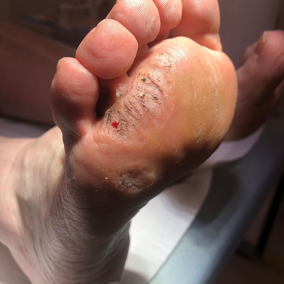 studio del podologo a Verona per cura di malattie del piede