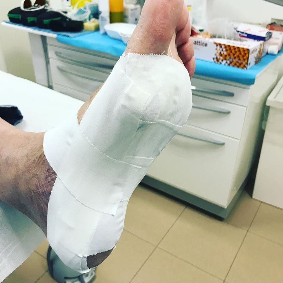 intervento del podologo a Verona