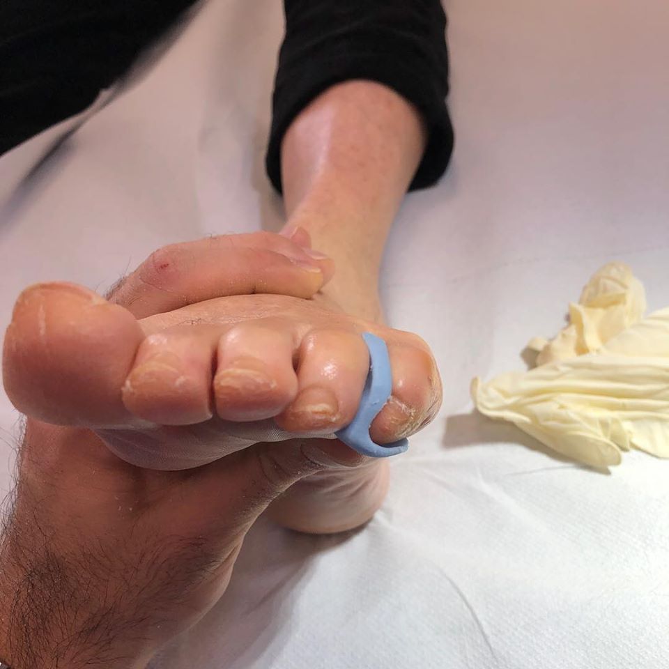 visita del podologo a Verona