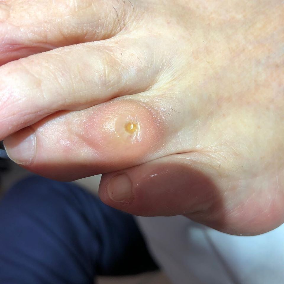 visita specialistica del podologo a Verona