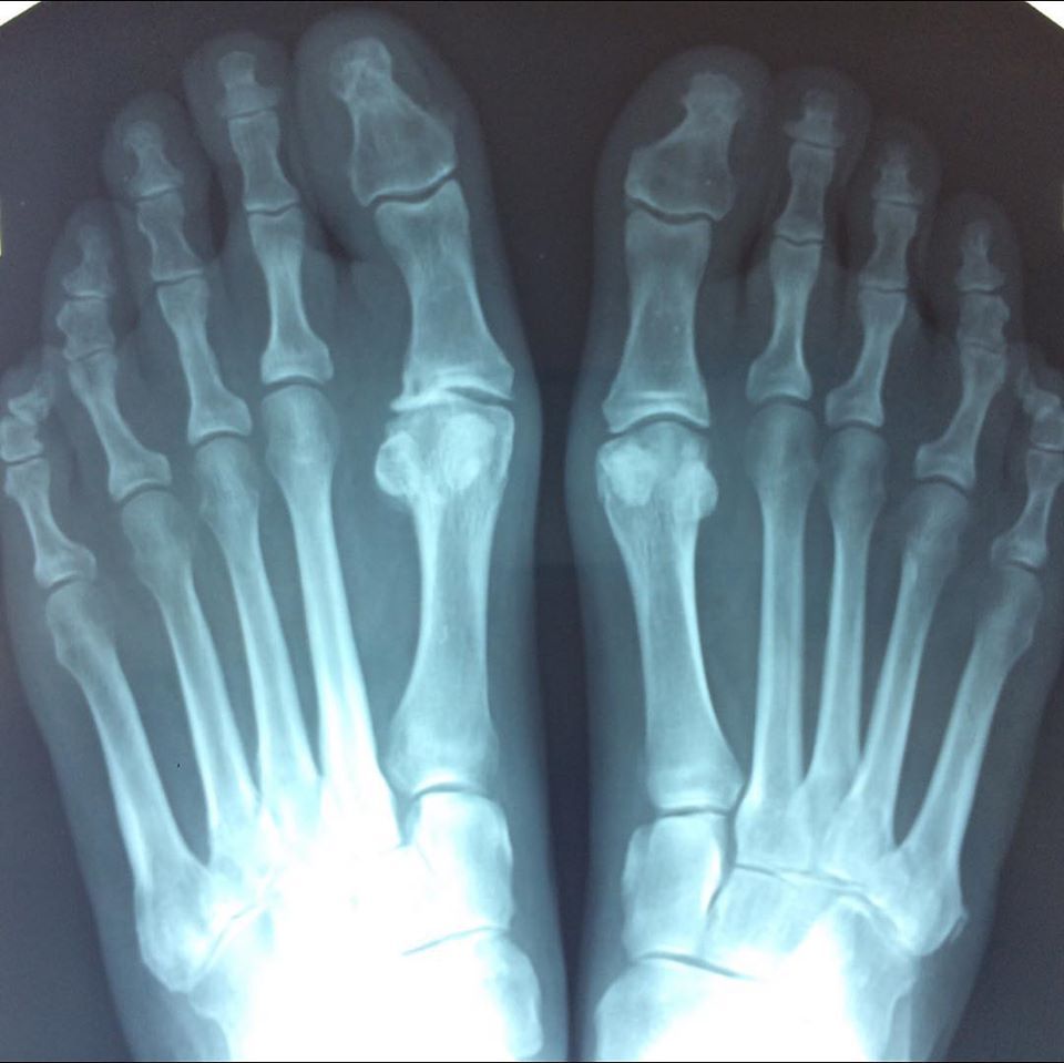 Radiografia del podologo a Verona