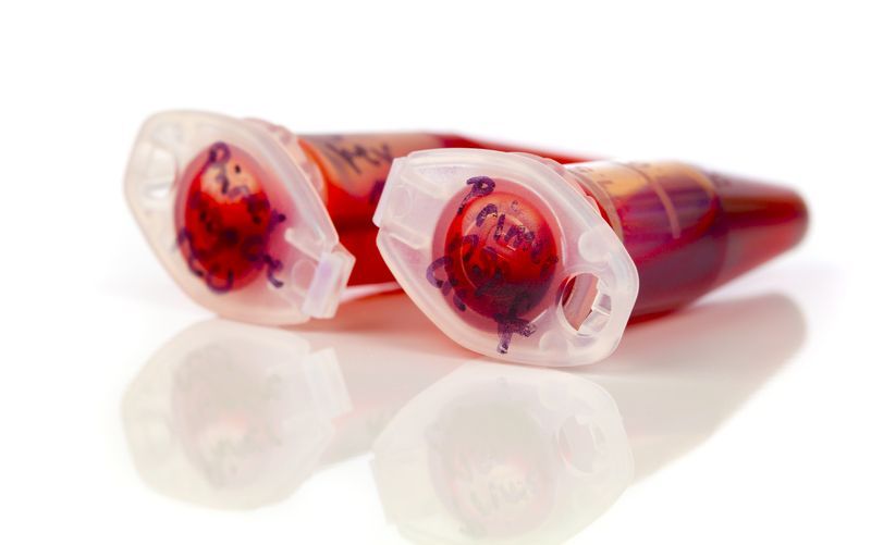Open blood sample vials with bright red liquid, reflective surface.