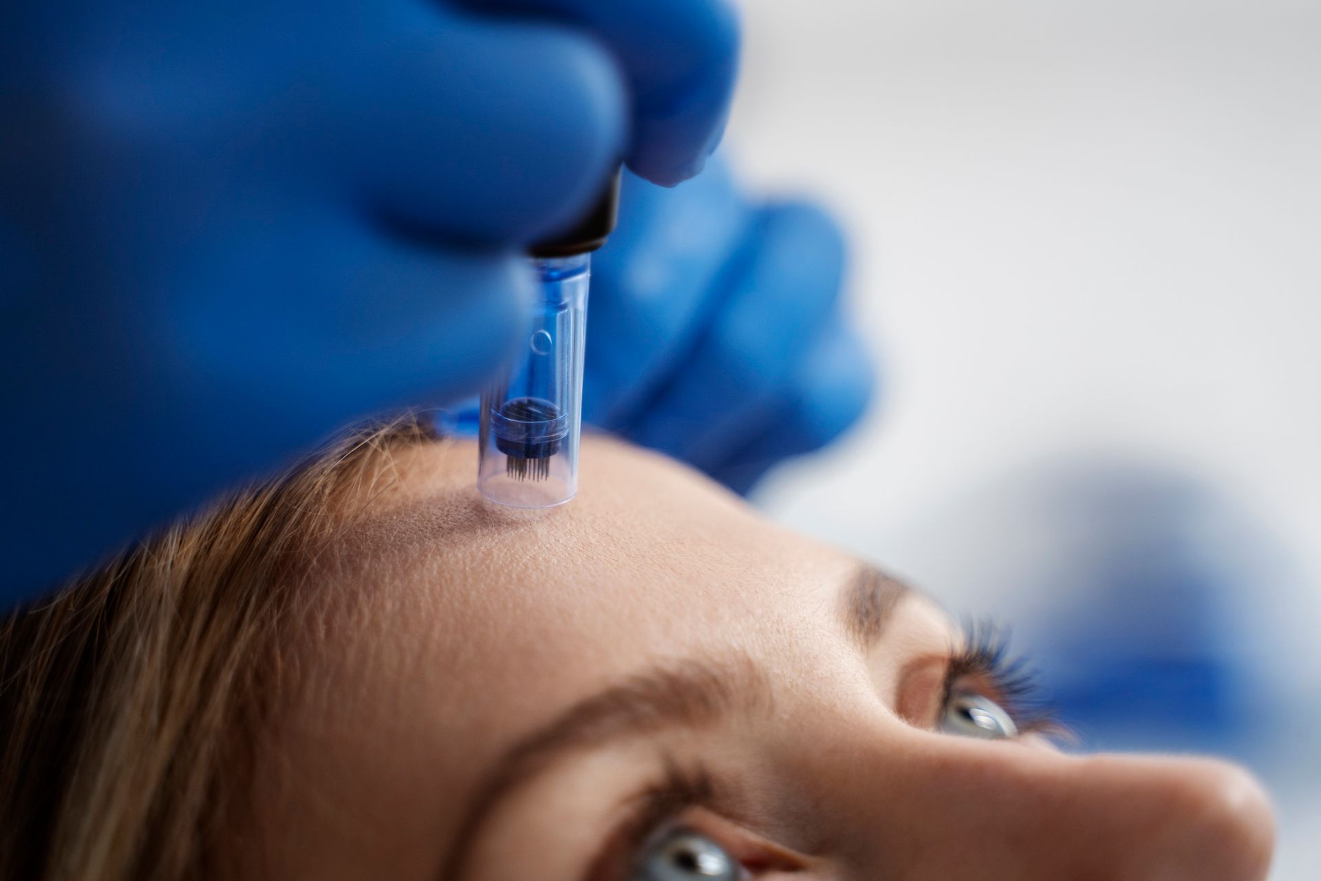 A woman is getting a botox injection in her forehead.