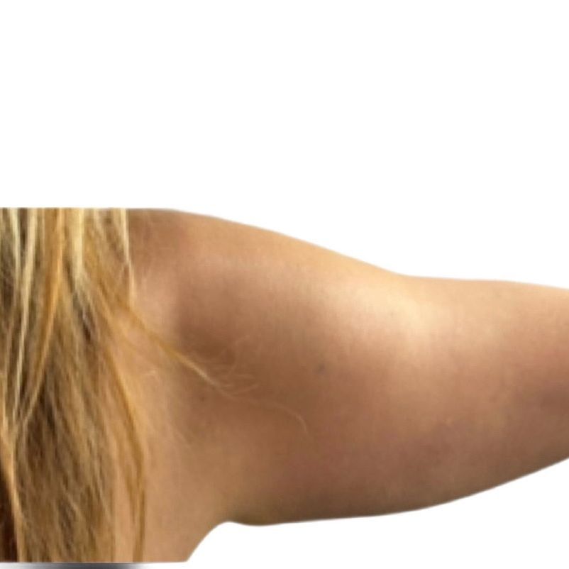 A woman 's arm is shown with a white background.