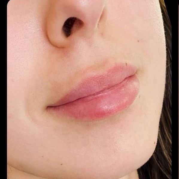 A close up of a woman 's lips and nose.