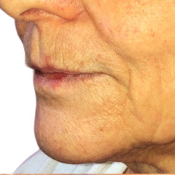 A close up of an older woman 's face with a white background.