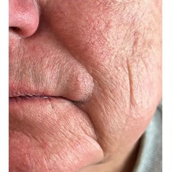 A close up of a man 's face with wrinkles on it.