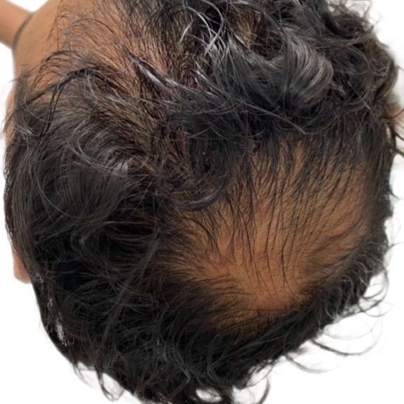 A close up of a person 's hair on a white background.