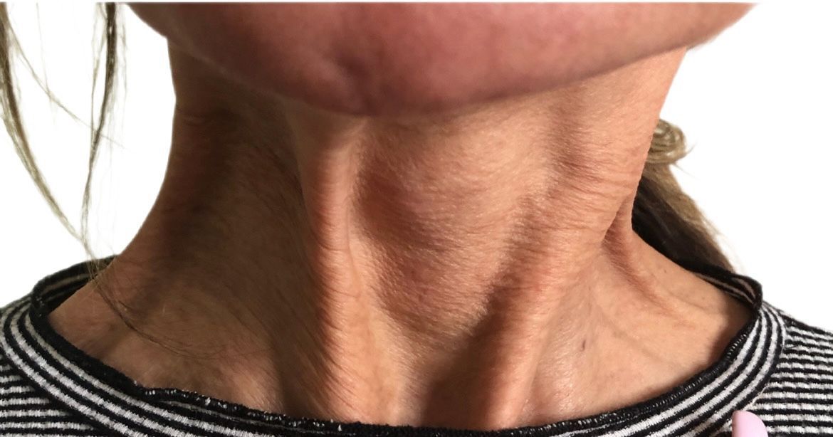 A close up of a woman 's neck with wrinkles.