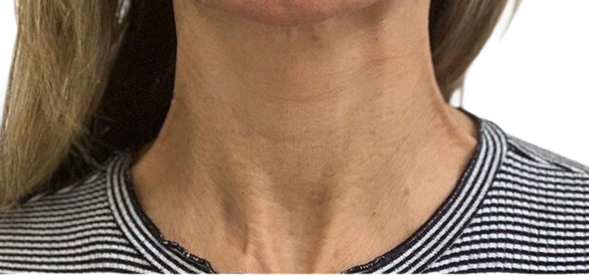 A close up of a woman 's neck and neckline in a striped shirt.