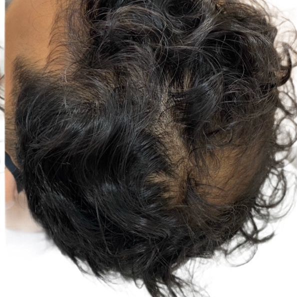 A close up of a person 's hair on a white background.