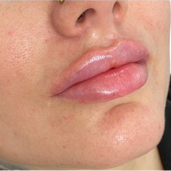 A close up of a woman 's lips with a nose ring.