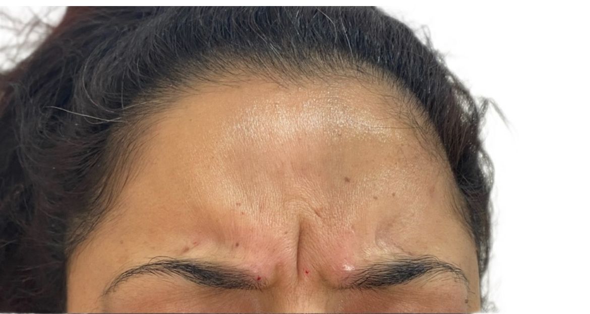 A close up of a woman 's forehead with her eyes closed.