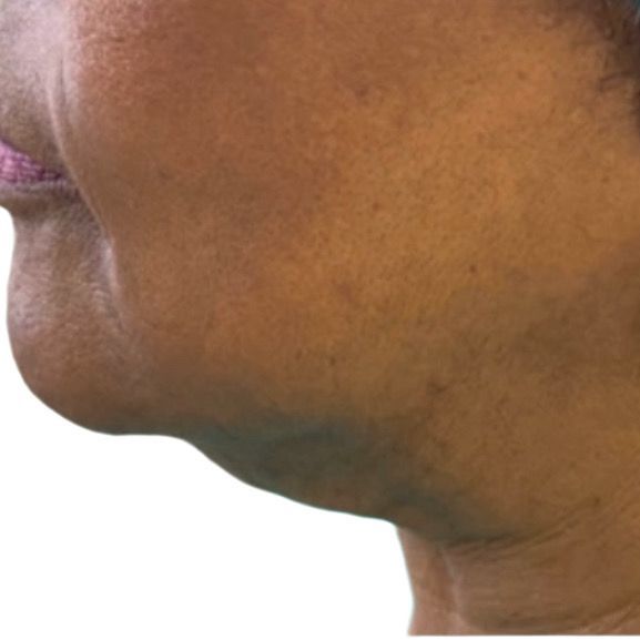 A close up of a woman 's face and neck on a white background.