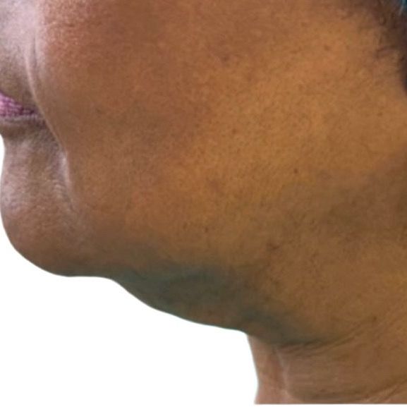 A close up of a woman 's face and neck on a white background.