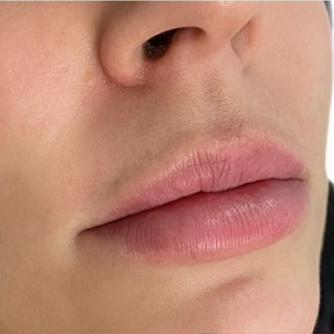 A close up of a person 's lips and nose.