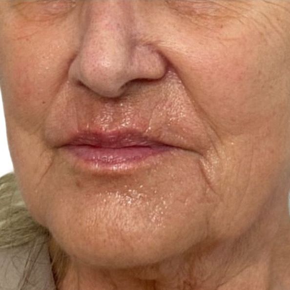 A close up of an older woman 's face on a white background.