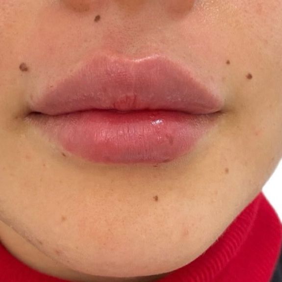 A close up of a person 's lips with a red shirt on