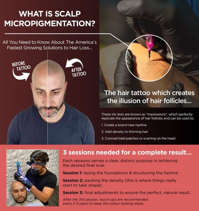 Scalp micropigmentation - SMP - Hair Tattoo Perth